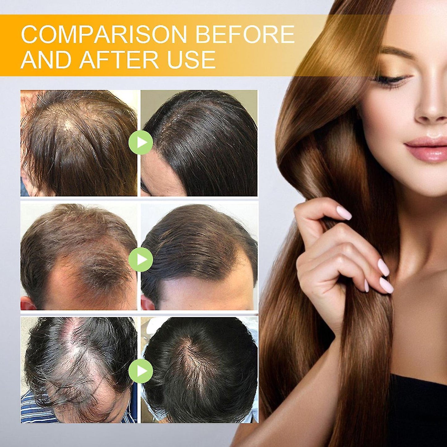 Biotin Hair Growth Spray, Hair (2PCS)